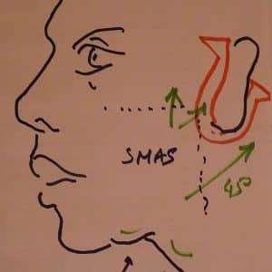 Smas par Vladimir Mitz